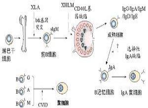 小儿X-连锁高免疫球蛋白M血症