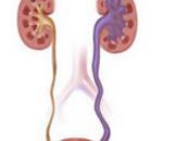 小儿膀胱-输尿管反流综合征