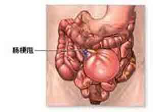 小儿肠吸收不良综合征