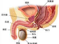 睾丸畸胎瘤