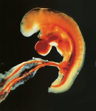 胎儿“胎动”有啥小秘密？