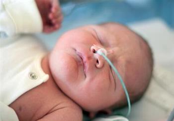 早产男婴患溶血症全身换血