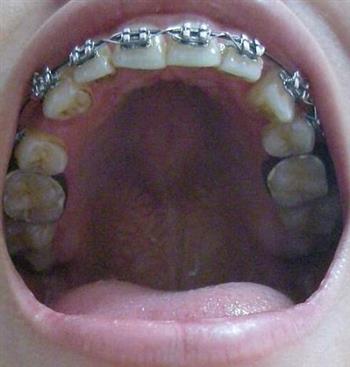 女性的“五期”如何护牙