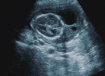 高龄产妇 胎儿颈部透明带检查